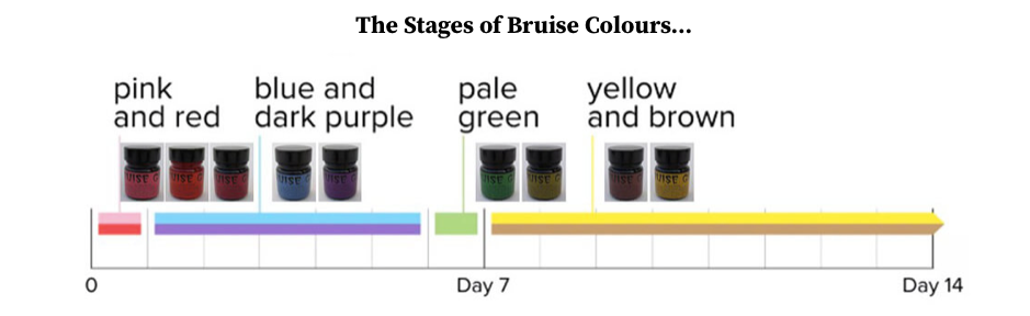 Glynn McKay Bruise Gels