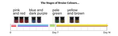 Glynn McKay Bruise Gels