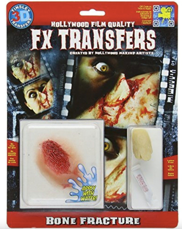 Tinsley FX Transfer - Bone Fracture